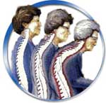 osteoporoza
